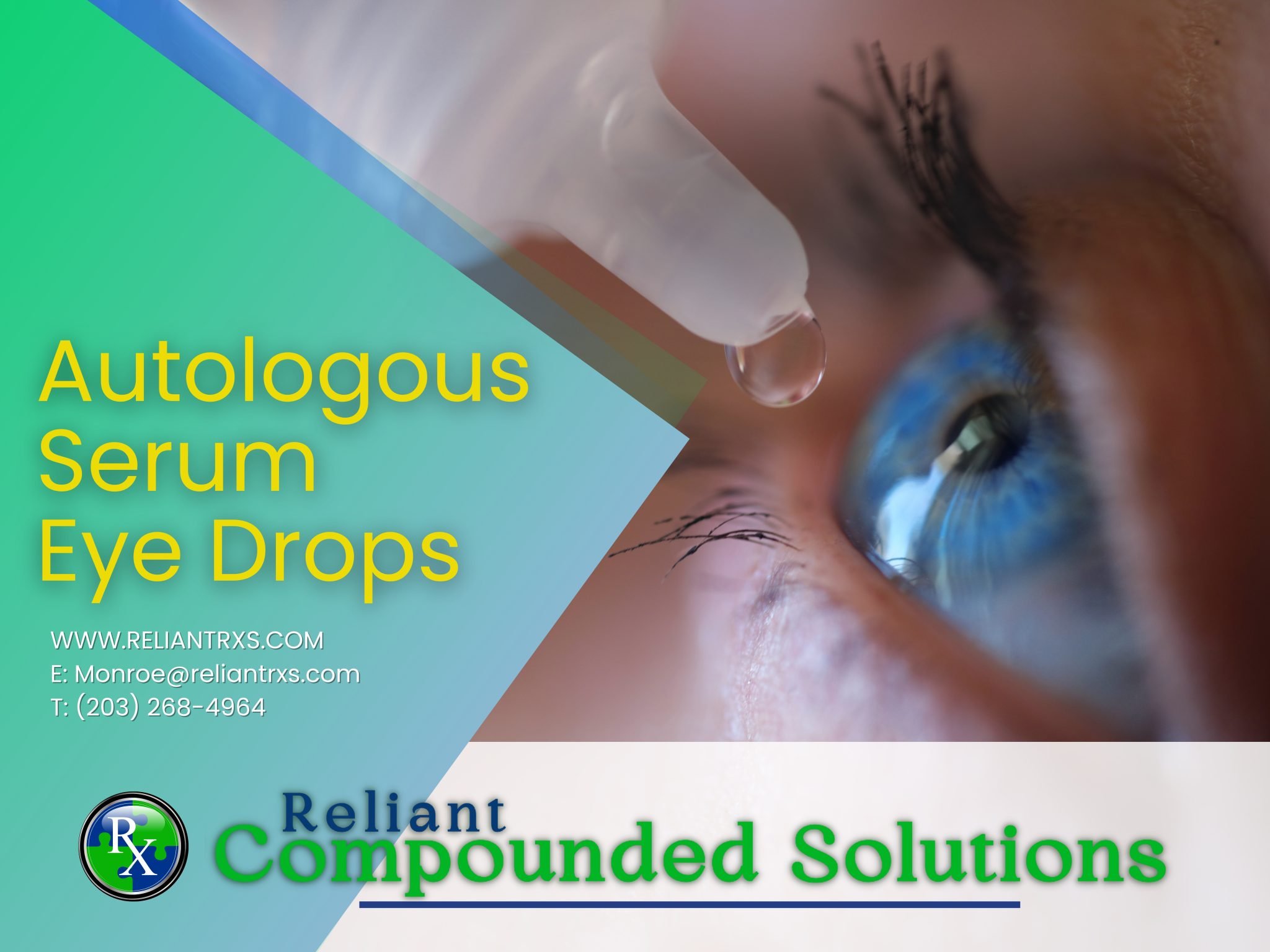 The Power of Autologous Serum Eye Drops Reliant Compounded Solutions